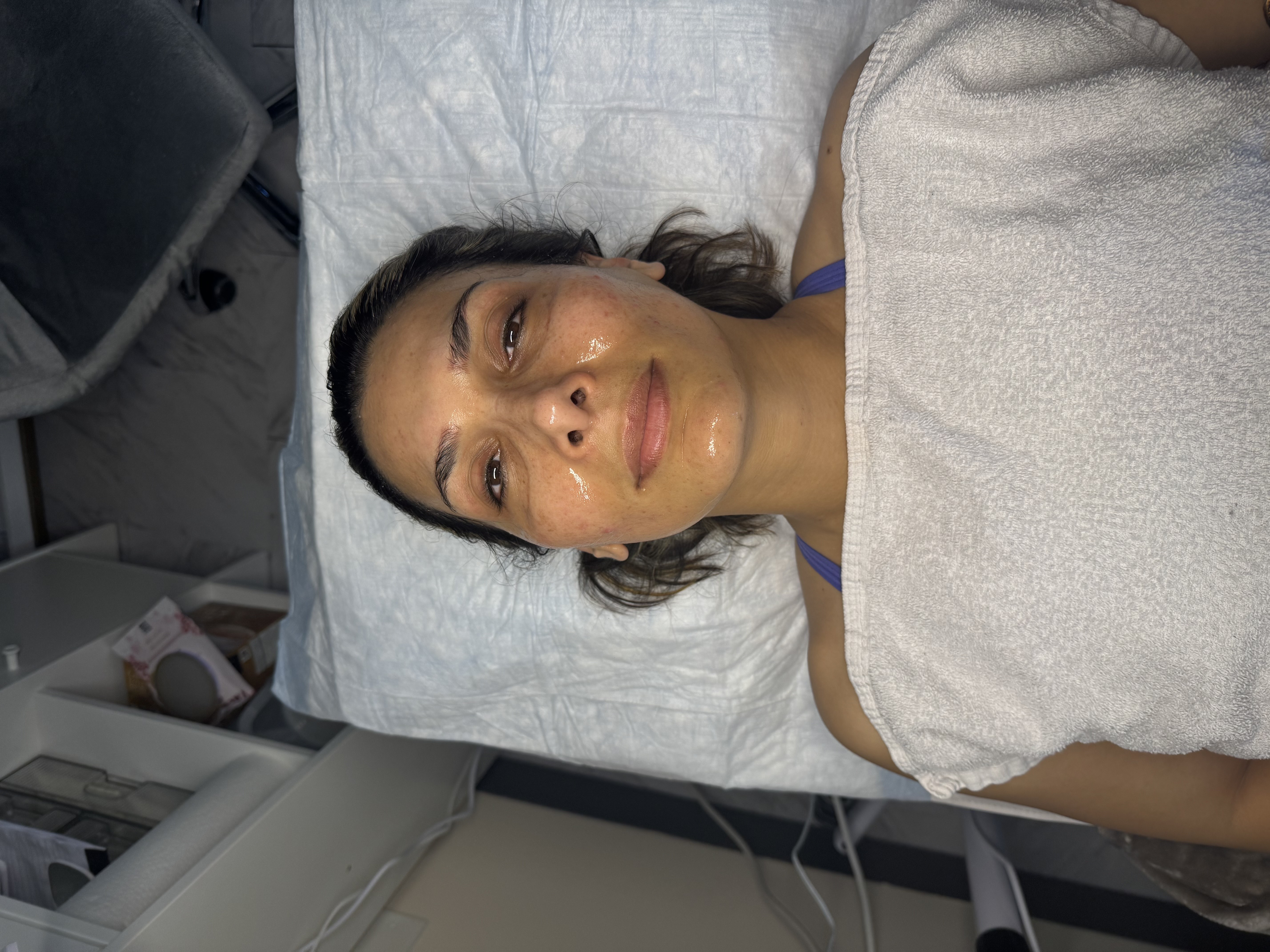 A woman laying in a hospital bed with a lot of wrinkles on her face